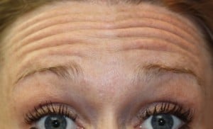 amybef