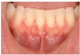 fgg1